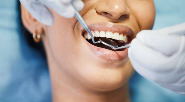 Best Chipped Tooth Repair Near Me  in Anderson Island, WA