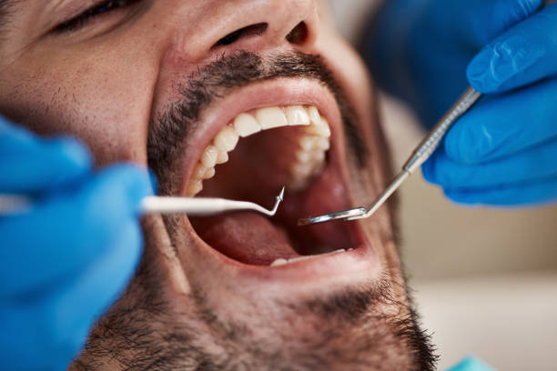 Best Affordable Emergency Dental Care  in Anderson Island, WA