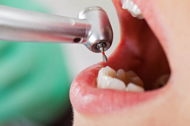 Dentist for Dental Trauma in WA